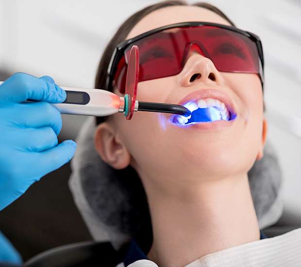 Houston Professional Teeth Whitening